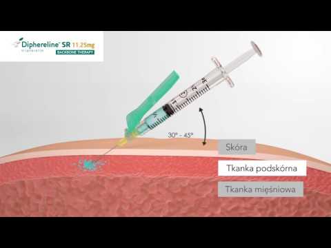 Vídeo: Dipherelin - Instruções De Uso, 3,75 Mg, Preço, Comentários, Análogos