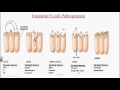 Enterobacteriaceae ( Escherichia coli _ Klebsiella pneumoniae).mp4