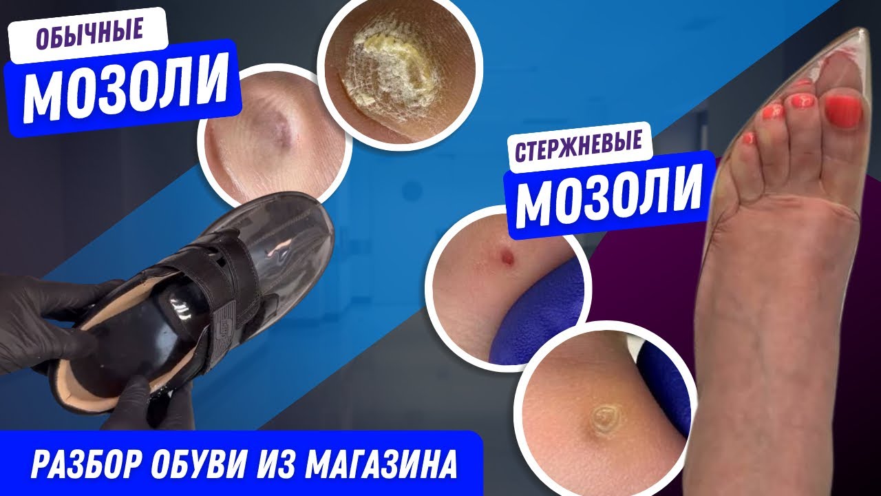 Стержневые мозоли / Обычные мозоли / Разбор обуви из магазина #обувь # ...