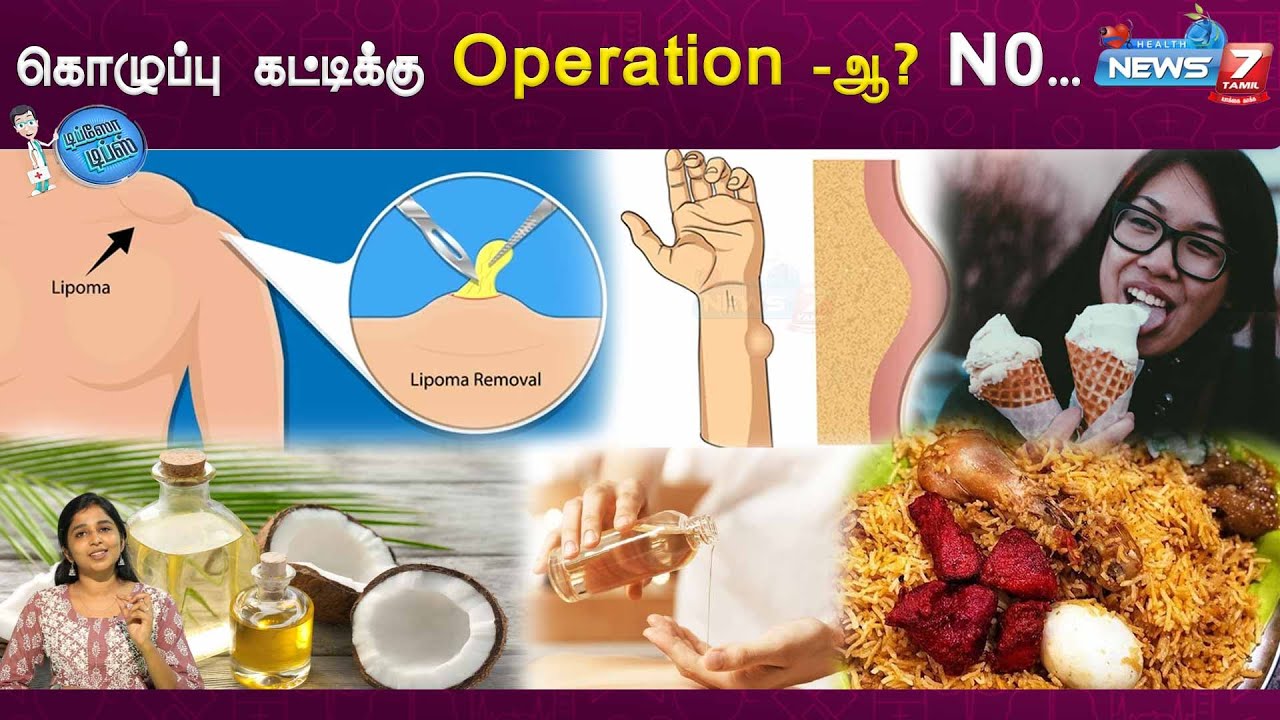 Operation செய்யாமல் கொழுப்பு கட்டி போகணுமா? |Dr.Sharmika Explains| kolupu  katti - YouTube