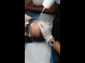 Лазерное удаление татуажа бровей по постоянной акции в Алматы