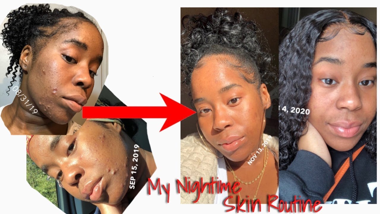 NIGHTTIME SKINCARE ROUTINE 2020 | How To Clear Dark Spots & Acne 🧖🏾‍♀️ ...