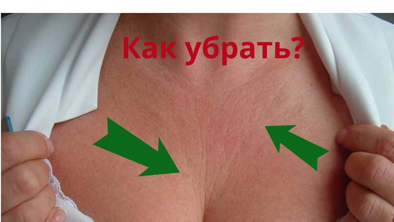 Омоложение шеи и лифтинг декольте. 3 в 1: маска для декольте, маска для груди, маска для шеи.