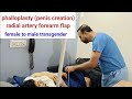 Phalloplasty for female to male transgenders by radial artery forearm flap  india usa uk bangladesh