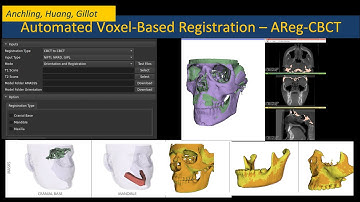 Automated Registration for CBCT (ARegCBCT) - Tutorial