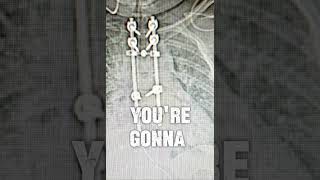 Survivor #yt #survival #support #subscribe #trauma #accident #hardwork #resilience #respect #strong