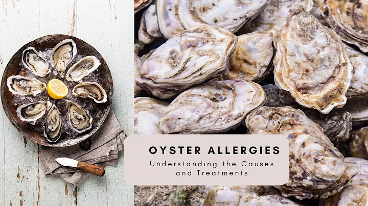 Oyster Allergies 🦪 Understanding the Causes and Treatments