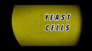 Yeast cells in stool routine Microscopy || @labmedicine9265