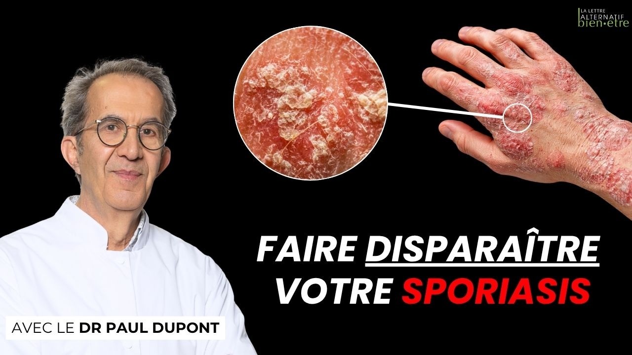 Pourquoi le psoriasis revient toujours : le secret que les dermatologues oublient