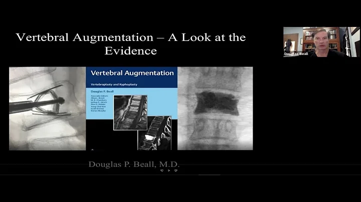 Vertebral Augmentation   A Look at the Evidence