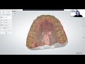 [Webinar] 3Shape Aligner Studio with Ortho Analyzer with Matthew Davis