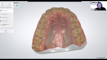 [Webinar] 3Shape Aligner Studio with Ortho Analyzer with Matthew Davis