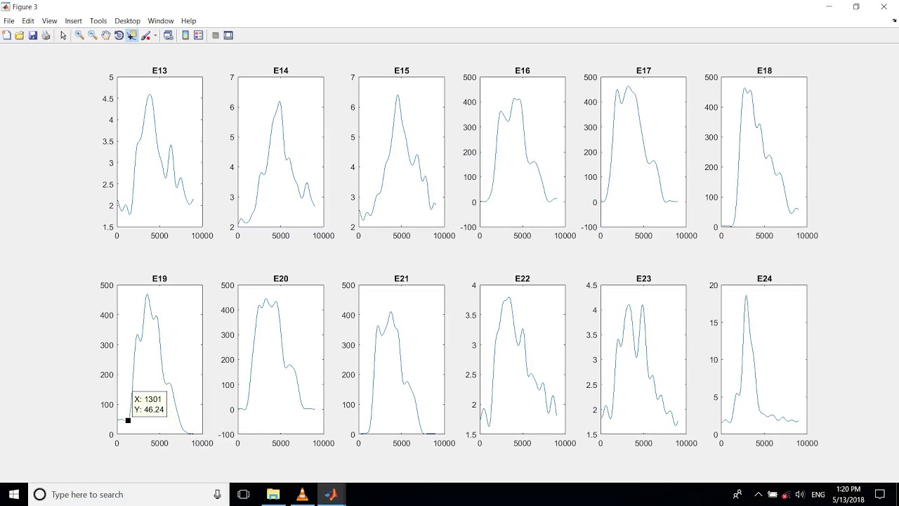 cursor_ST, cursor_UT EMG Data processing matlab for upper exercises mm ...