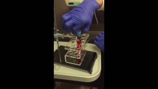 Preparing a PRP Injection Final Edit