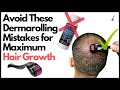 5 Dermarolling MISTAKES to AVOID for Hair Growth!