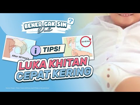 Video: Cara Mudah Merawat Bayi Sunat: 9 Langkah (Berikut Gambar)