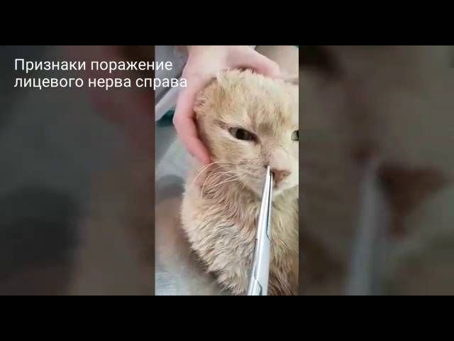 До и после : отит среднего уха