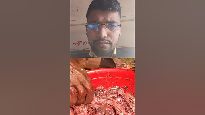 মাছের ফেলে দেয়া নাড়িভুঁড়ি থেকে তেল!Fish Oil | News24