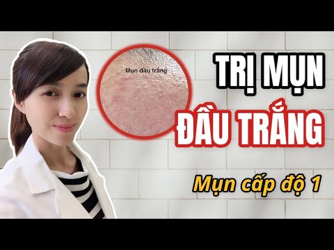 Mụn Đầu Trắng Và Cách Điều Trị - #23. MỤN ĐẦU TRẮNG : NGUYÊN NHÂN, NHẬN BIẾT, CÁCH TRỊ MỤN ĐẦU TRẮNG HIỆU QUẢ || Mỹ Phẩm Hữu Cơ DR.HC