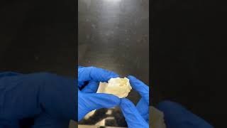 Ethmoid Bone