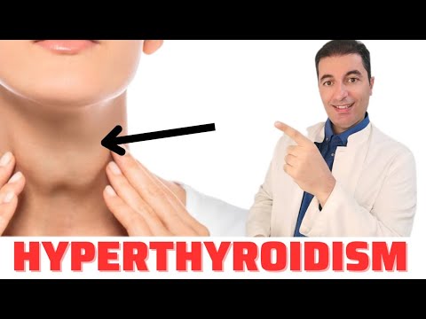 Video: Treba li prestati uzimati tiroksin prije operacije?