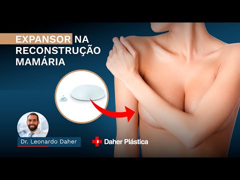 EXPANSOR NA RECONSTRUÇÃO MAMÁRIA | Dr. Leonardo Daher