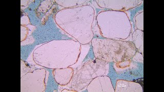 Famous Thin section 1 Net Worth