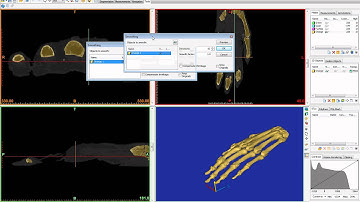 Learn how to create 3D models (STL) in MIMICS 13