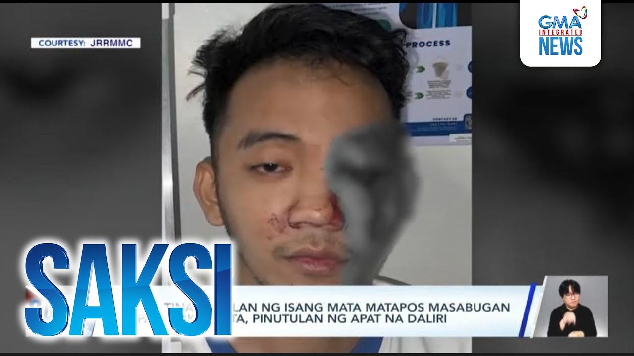Lalaki, tinanggalan ng isang mata matapos masabugan ng paputok | Saksi