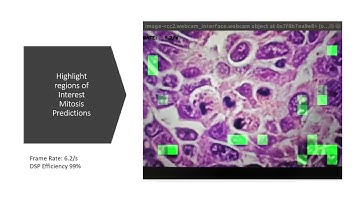 Mitosis Detection with Deep Learning