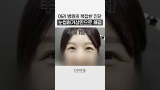 처진 눈꺼풀, 진단명이 다 달랐다!? [눈썹하거상] 하나로 해결! ✅