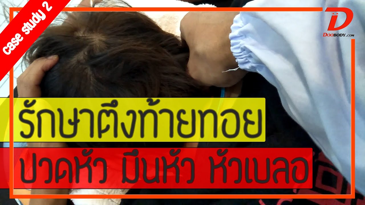 [คลิป 185] (case study02) รักษาปวดท้ายทอย มึนหัว หัวเบลอ จากทับหลอดเลือดคอ (part1)
