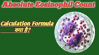 Absolute eosinophil count formula | How to manual count eosinophil |absolute eosinophil normal value