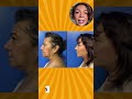 Neogen Plasma en Sunshine Spine | Rejuvenecimiento Natural de la Piel en Jacksonville, FL