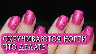 Что делать, если скручиваются ногти