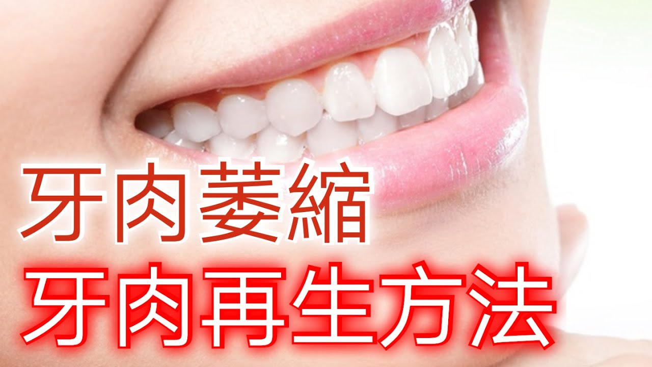 【牙肉萎縮】自然療法