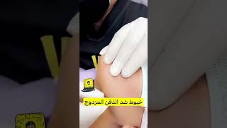 شد اللغد بخيوط الشبكه