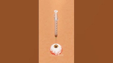 Needle Dropping On Eye | Infinite loop  #3danimation #cartoon #spiderman #3dmodeling