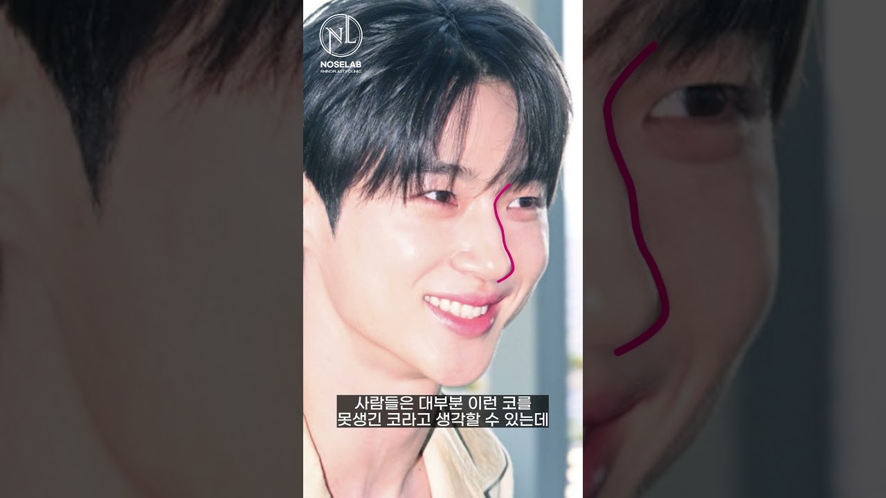 변우석 코 모양 분석과 남자 코성형 포인트