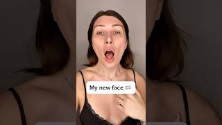 New face but still swollen 🏳️‍⚧️ #transgender #fyp #woman #surgery #transition