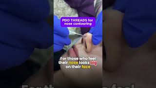 Get slim nose | Nose slimming | thin nose treatment | #nosesurgery