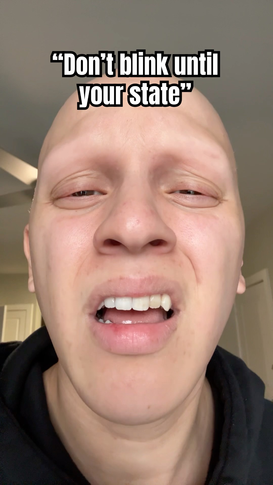 YOU TRY IT! ?? my eyes BURN! #comedy #funny #lol #challenge