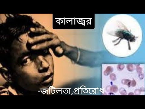 কালাজ্বর (জটিলতা, প্রতিরোধ) | Lishmeniasis | Kala azar