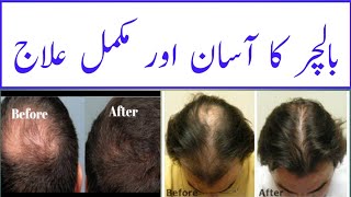 hair fall treatment  balchar ka elaaj