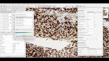 QuPath: How to set Set Thresholds for DAB nuclear staining using Measurement Maps