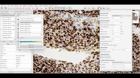 QuPath: How to set Set Thresholds for DAB nuclear staining using Measurement Maps