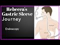 My Gastric Sleeve Story/ Episode 5: Endoscopy