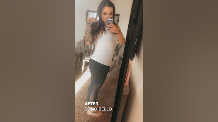 Mommy Makeover Review from Sono Bello | TriSculpt & AbEX Review