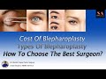 Cost of blepharoplasty  types of blepharoplasty  how to choose your surgeon  dr shobhit gupta
