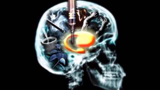 Youcef Abdjaoui Fkigh Araye Irayiwe By Pipo